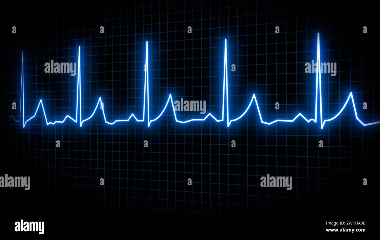 Herzfrequenz-Elektrokardiogramm-Bildschirm mit Gitterhintergrund Stockfoto