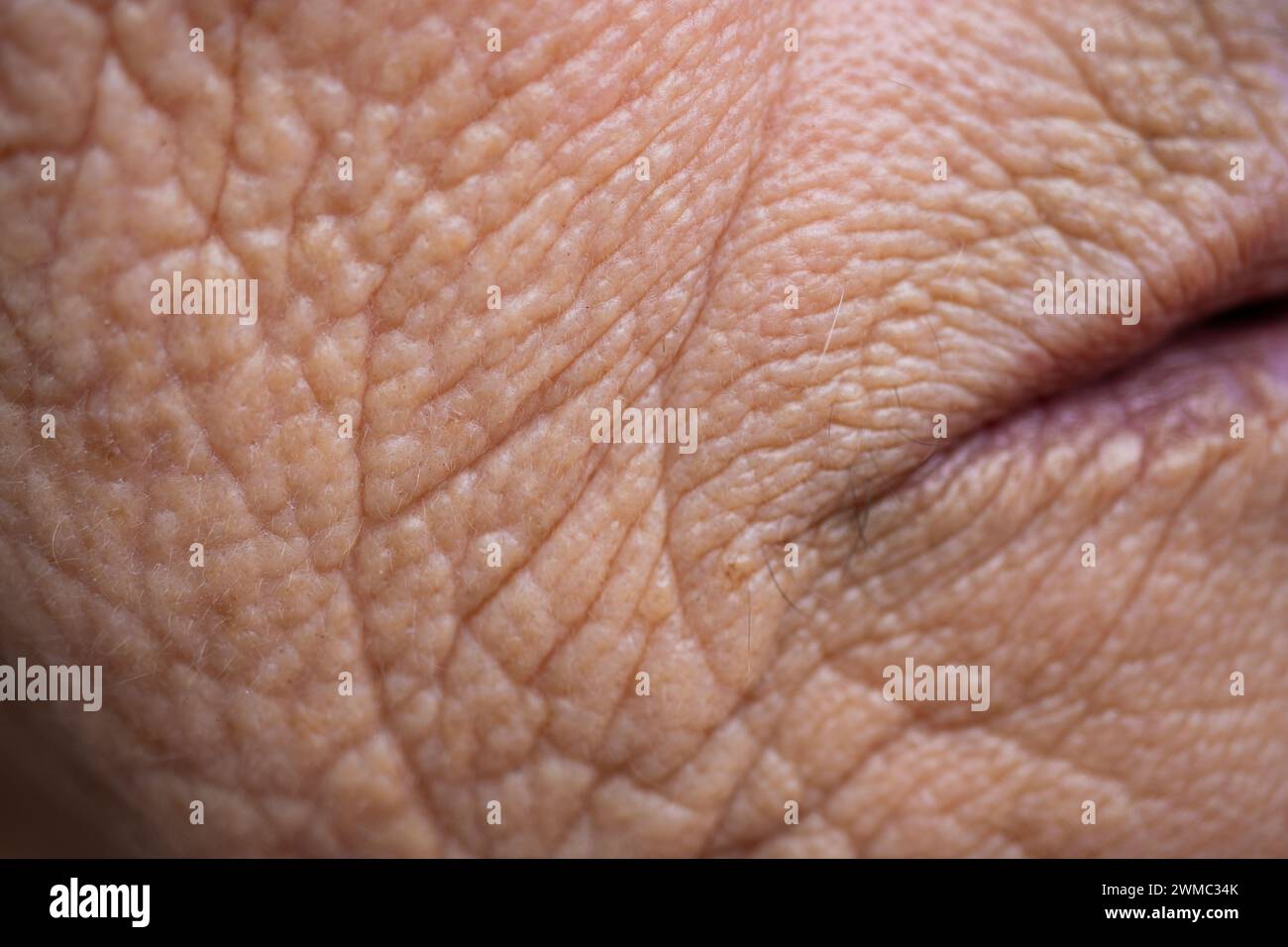 Makrofotografie des Gesichtsausschnitts einer älteren Frau. Die Haut ist von der Zeit geprägt, voller tiefer Falten. Faltige Haut. Zeichen des Alters. Stockfoto