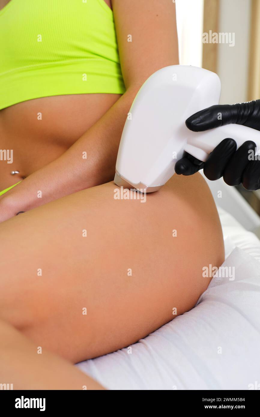 Nahaufnahme einer Laser-Haarentfernung auf der Haut eines Kunden, durchgeführt von einem Fachmann mit Schutzhandschuhen Stockfoto