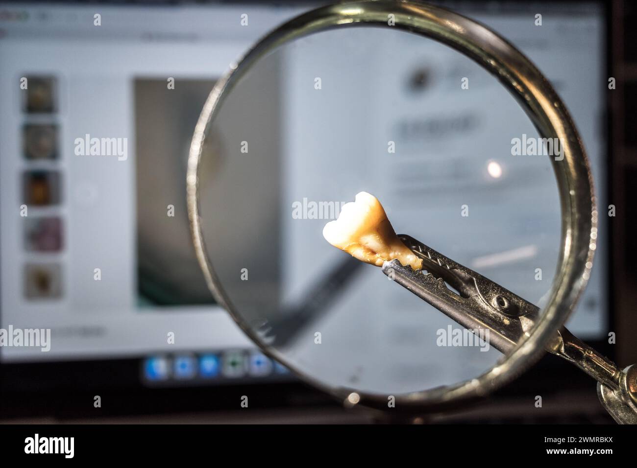 Seattle, USA. Januar 2024. Ein menschlicher Zahn, der von ebay auf einem Laptop mit der Liste gepuchelt wurde. Stockfoto