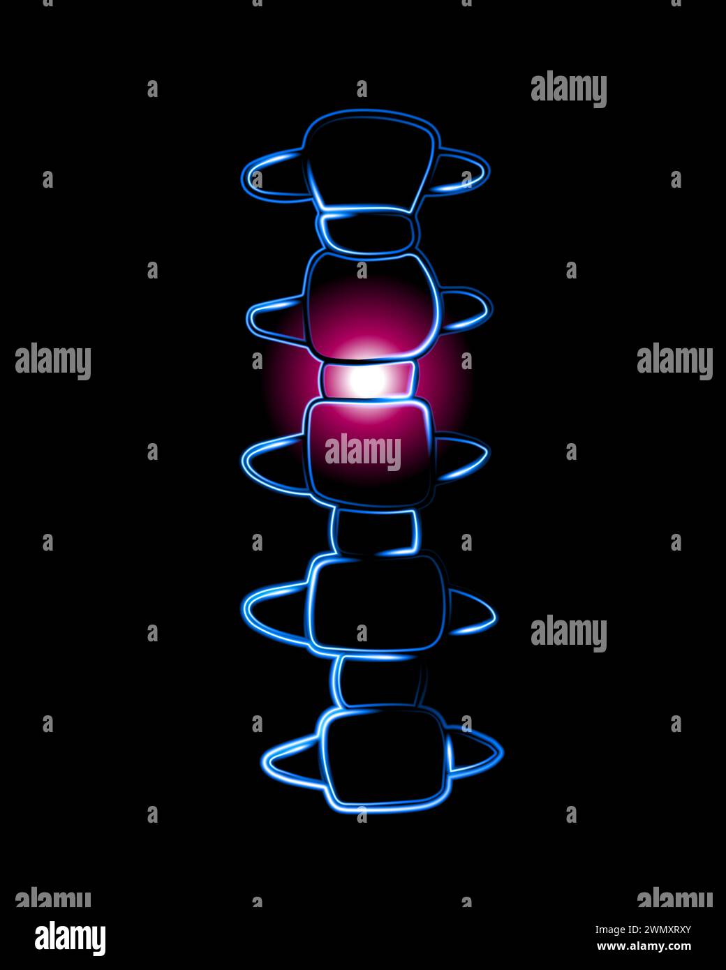 Vektorisolierte Darstellung der Halswirbel. Neonkonturzeichnung der Halswirbelsäule. Nackenschmerzen. Wirbelverlagerung. Stock Vektor
