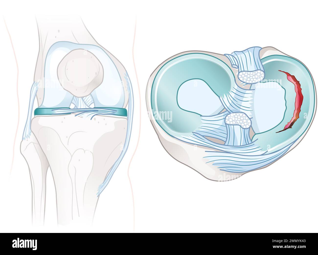 Menisken sind C-förmiger Knorpel in den Knien, der die Gelenke abfedert und stabilisiert. Kreuzbänder stabilisieren das Knie und verbinden Oberschenkel und Schienbein. Stockfoto