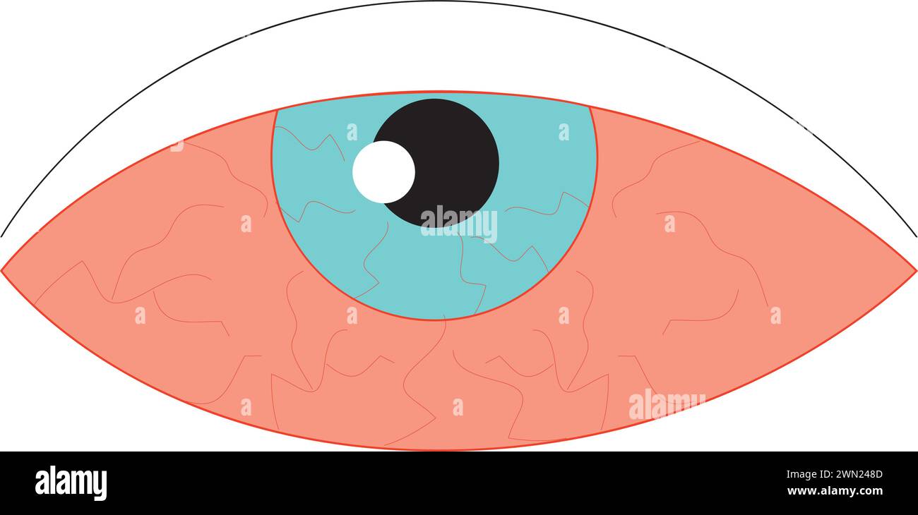 Augenwundlinie Symbol, Krankheit und Allergie, Augenrötung Vektor Symbol, Vektor-Grafiken Stock Vektor