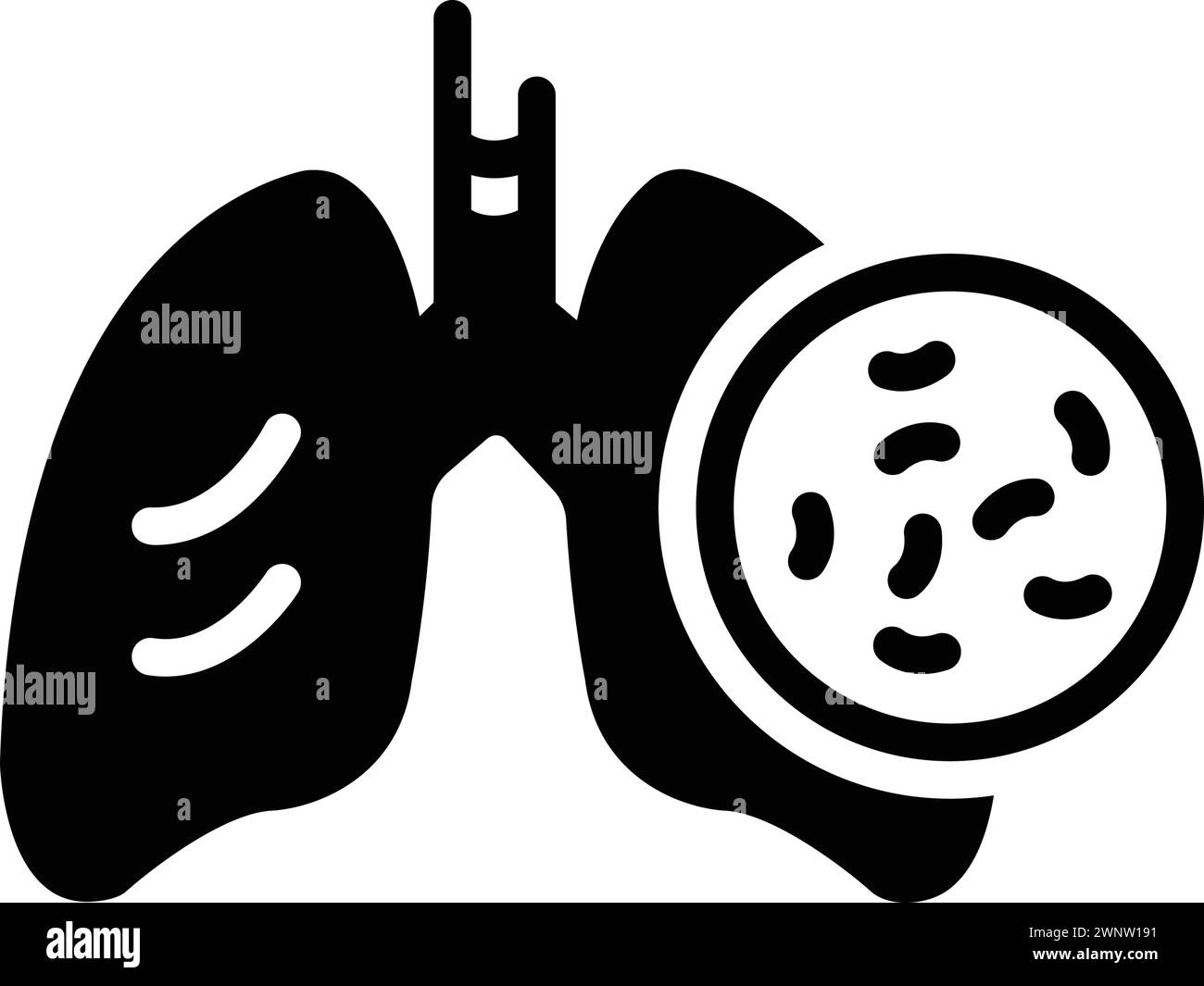 Symbol für tuberkulose, Tuberkulose Stock Vektor