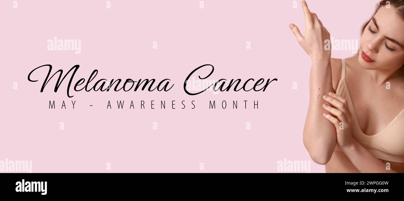 Junge Frau mit Muttermalen und Text MELANOM CANCER AWARENESS MONTH auf rosa Hintergrund Stockfoto
