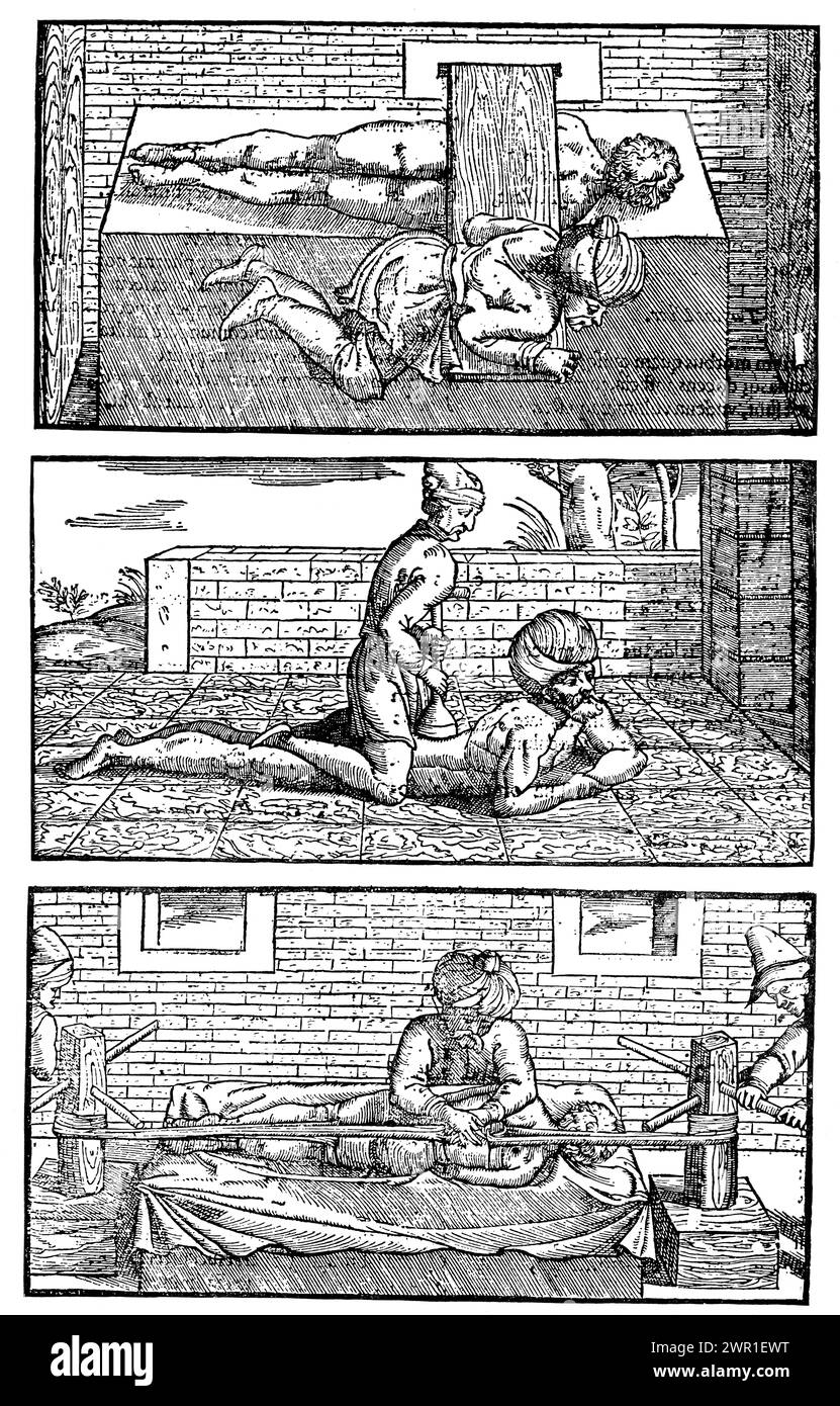 Avicenna-Heilmittel für Wirbelsäulenfrakturen, 15. Jahrhundert. Vom Kanon der Medizin. Der Kanon der Medizin ist eine Enzyklopädie der Medizin in fünf Büchern, die der persische Arzt-Philosoph Avicenna (980–1037) zusammengestellt und 1025 fertiggestellt hat. Stockfoto