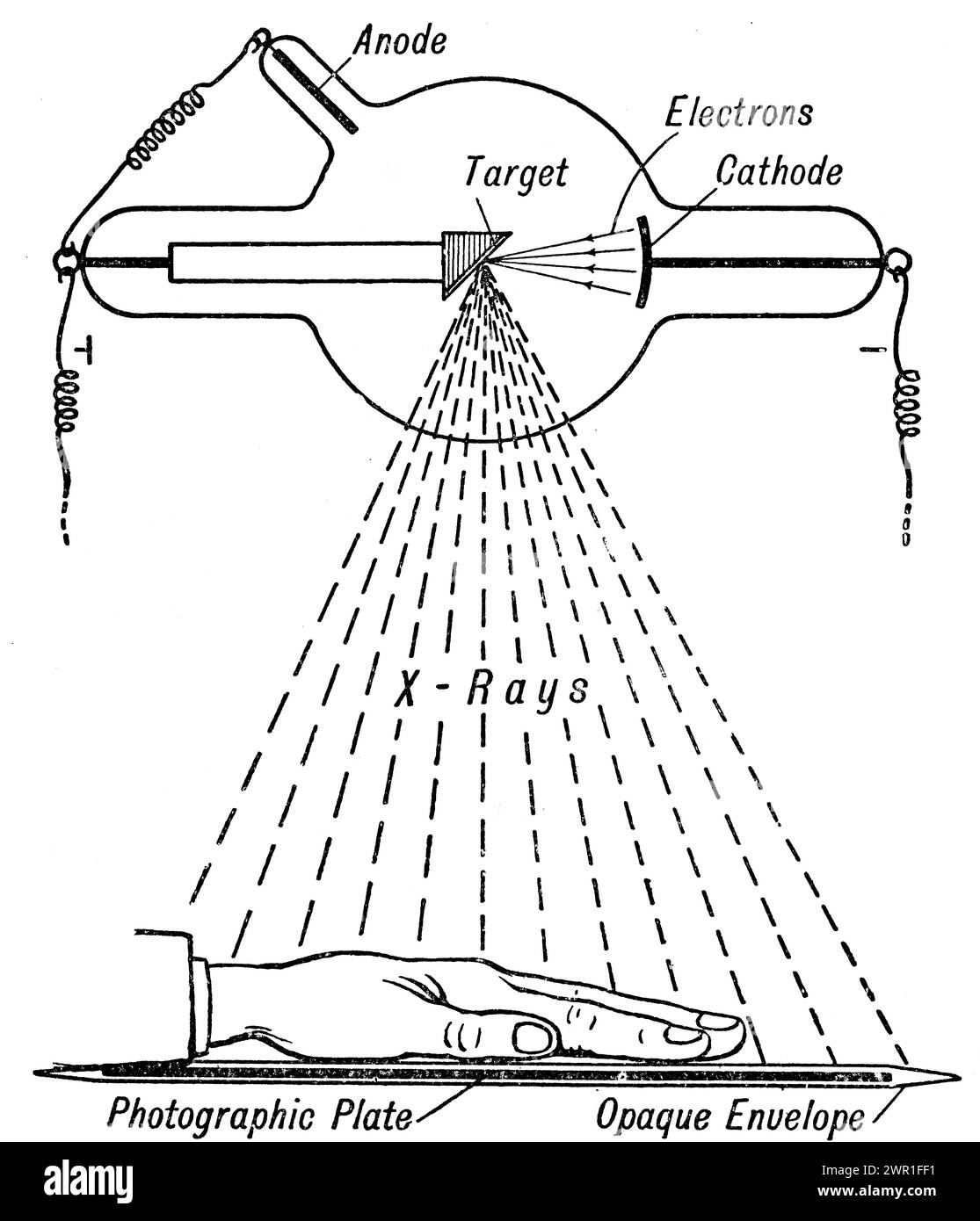 Ein Diagramm einer Crookes-Röhre. Eine Crookes-Röhre ist eine frühe experimentelle elektrische Entladungsröhre mit partiellem Vakuum, die von dem englischen Physiker William Crookes (1832–1919) und anderen um 1869–1875 erfunden wurde und in der Kathodenstrahlen, Elektronenströme, entdeckt wurden. Wilhelm Röntgen (1845–1923) entdeckte 1895 Röntgenstrahlen mit der Crookes-Röhre. Stockfoto