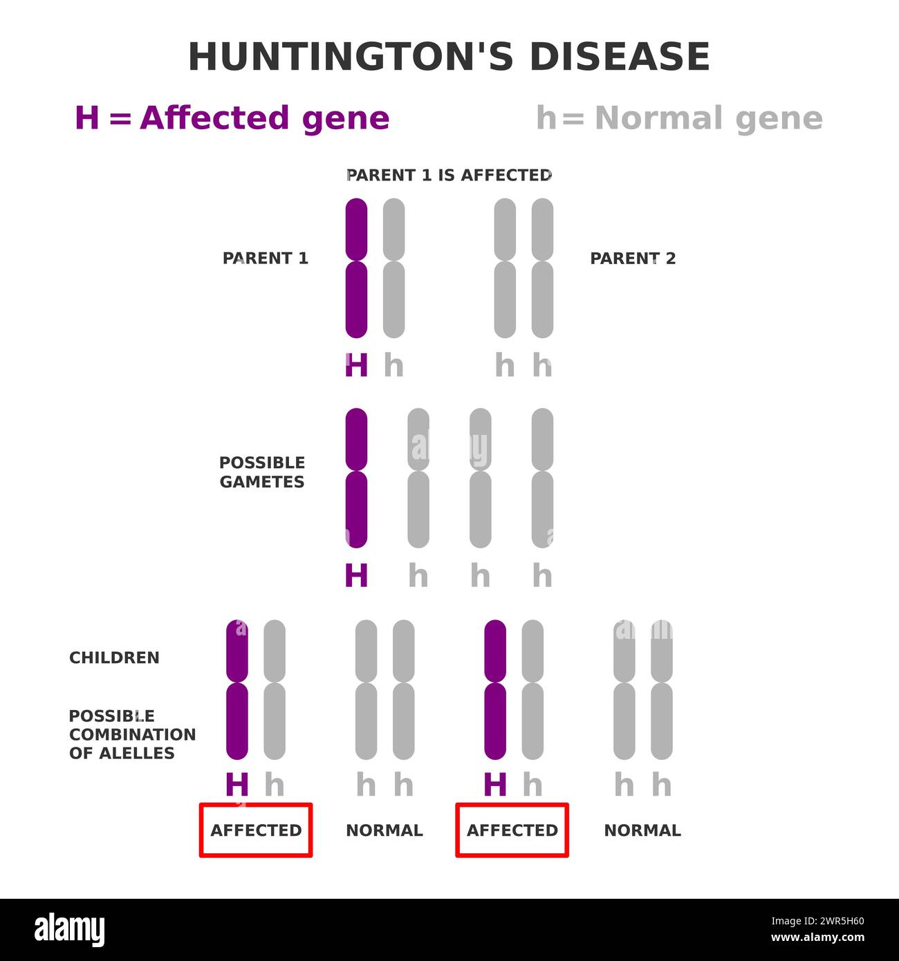 Genetik der Huntington-Krankheit. Autosomal dominante Vererbung. Ein übergeordnetes Element ist betroffen. Kinder haben fünfzig Möglichkeiten, Krankheit zu erben. Stock Vektor