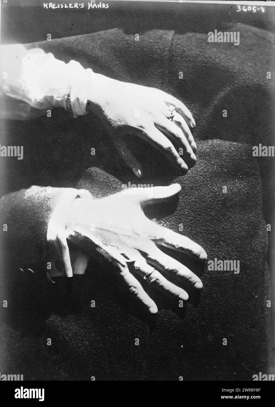 Kreislers Hände, Foto zeigt die Hände des Geigers Fritz Kreisler (1875-1962)., zwischen ca. 1910 und ca. 1915, Glasnegative, 1 negativ: Glas Stockfoto