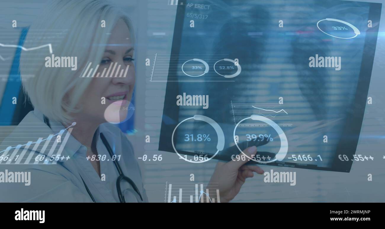 Bild der Datenverarbeitung und Statistik über Ärztin und Patientin, die sich einen Röntgenscan anschauen Stockfoto