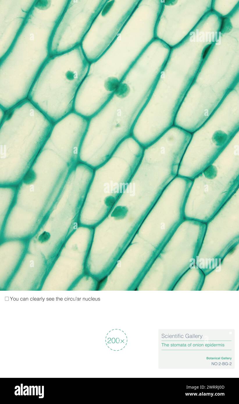 Die Struktur epidermaler Zwiebelzellen umfasst Zellmembran, Zytoplasma, Zellkern, Zellwand, Vakuolen, und keine Chloroplasten. Stockfoto