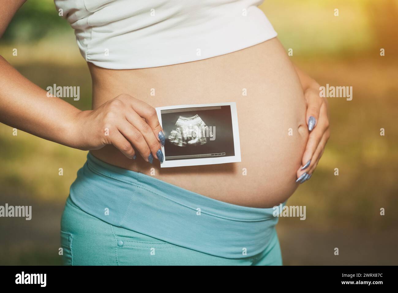 Erwachsene schwangere Frau, die ein Foto hält medizinischer Ultraschall in der Nähe des Abdomens auf einem Naturhintergrund. Stockfoto