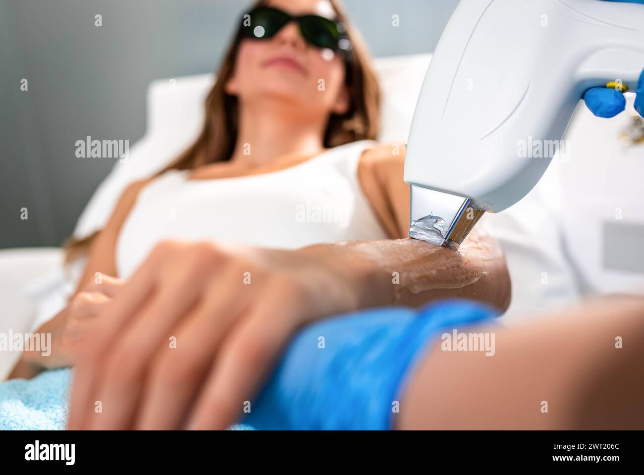 Die Frau in einem Schönheitssalon entfernt Haare aus ihrem Arm mit Laser-Epilierung. Stockfoto