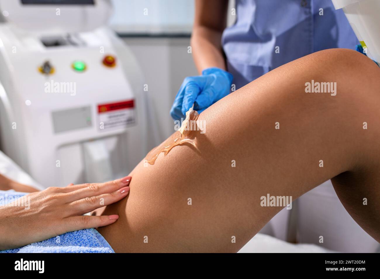 Die Frau in einem Schönheitssalon entfernt ihr Bein mit Laserepilierung. Stockfoto
