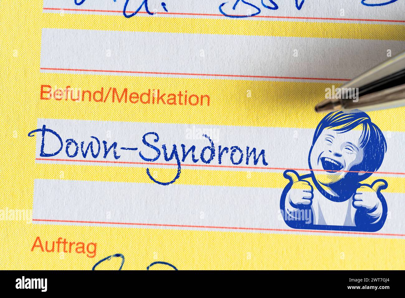 16. März 2024: Symbolisches Bild des Down-Syndroms. Befundbericht des Arztes mit Inschrift: Down-Syndrom und Kindersymbol. PHOTOMONTAGE *** Symbolbild-Down-Syndrom. Befund Bericht vom Arzt mit Aufschrift: Down-Syndrom und ein Kind Symbol. FOTOMONTAGE Stockfoto