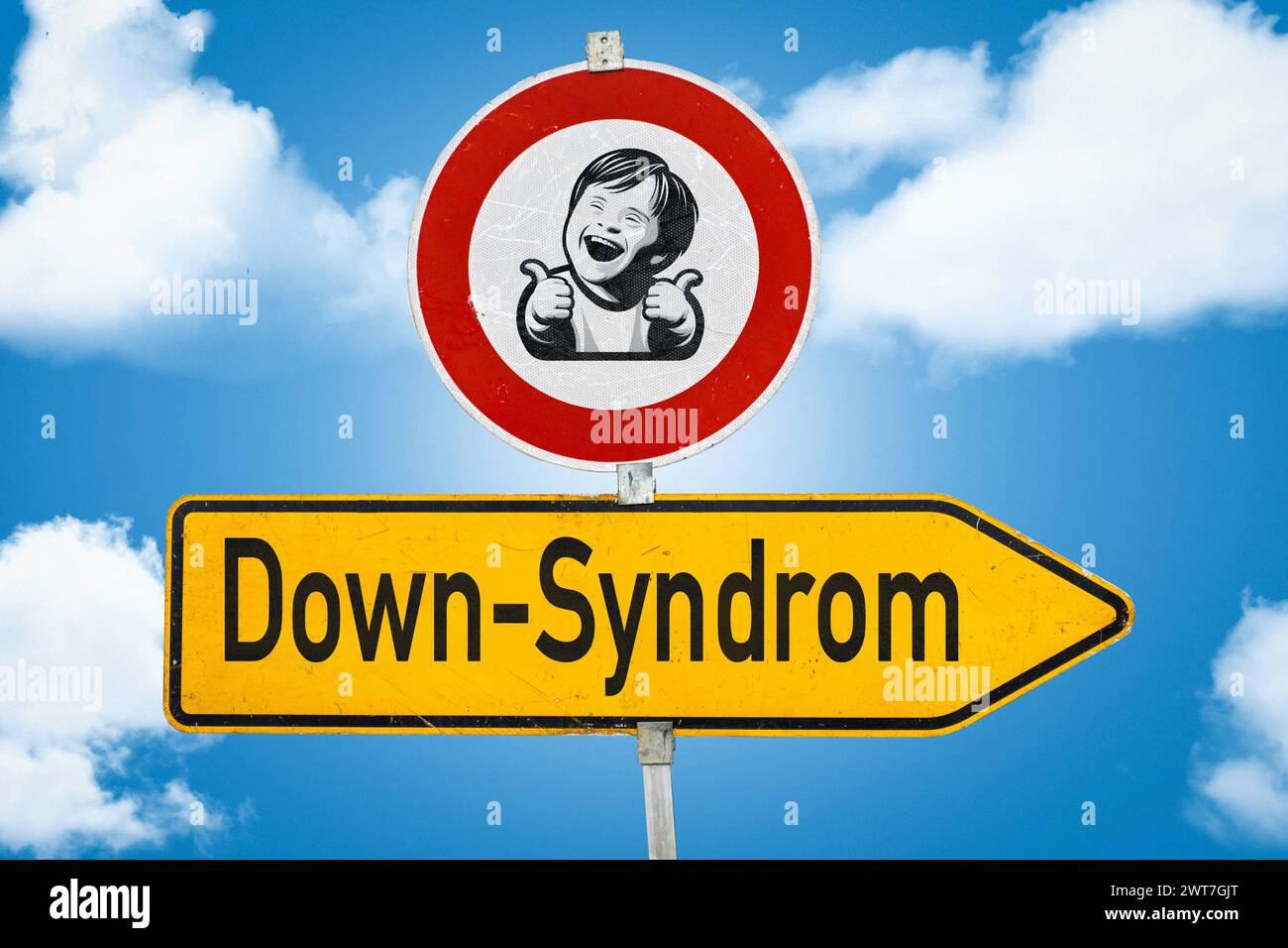 16. März 2024: Verkehrsschild vor blauem Himmel mit Kindersymbol und Aufschrift: Down-Syndrom. FOTOMONTAGE *** Verkehrsschild vor blauem Himmel mit einem Kind Symbol und der Aufschrift: Down-Syndrom. FOTOMONTAGE Stockfoto