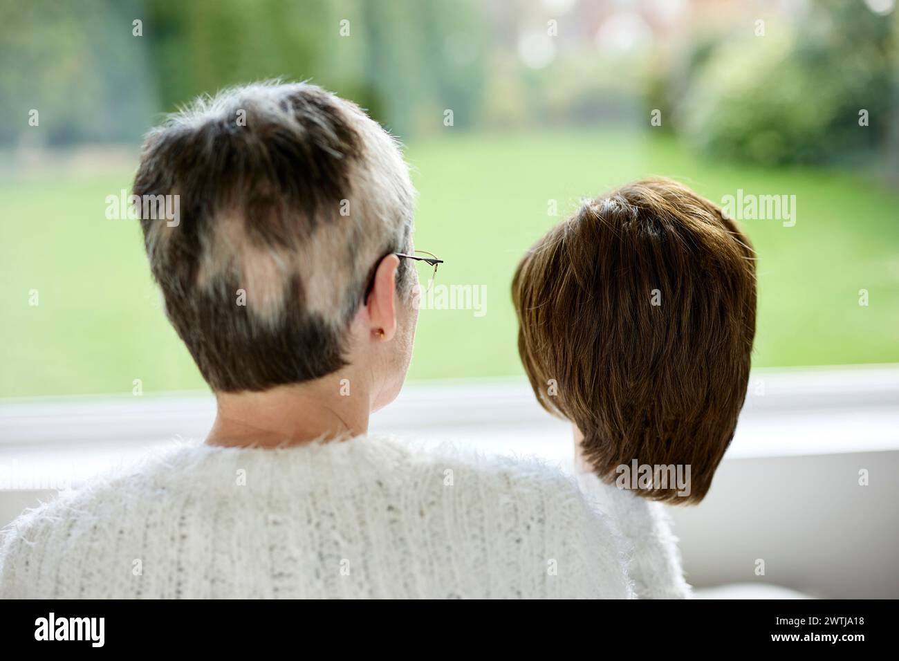 Frau mit Alopezie, die eine Perücke hält Stockfoto