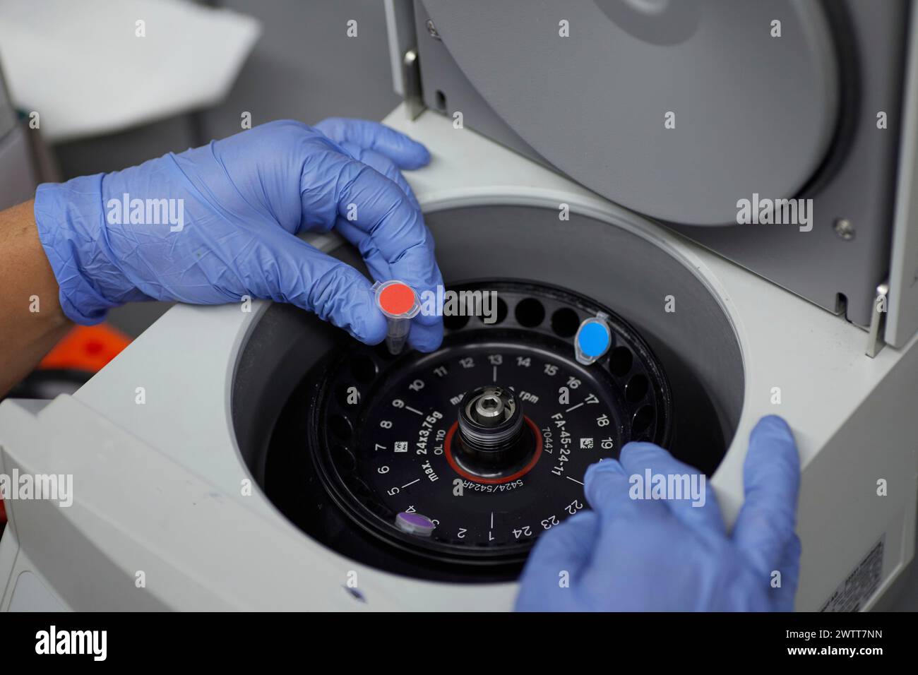 Attraktive Wissenschaftlerin untersucht Bio-Material mit medizinischen Geräten blutiges Spinnen Stockfoto