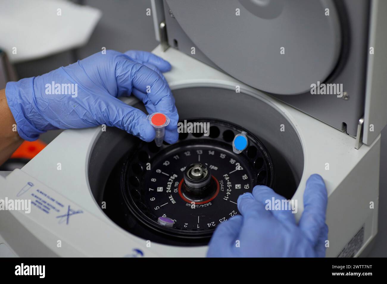 Attraktive Wissenschaftlerin untersucht Bio-Material mit medizinischen Geräten blutiges Spinnen Stockfoto