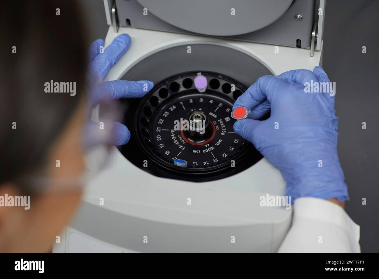Attraktive Wissenschaftlerin untersucht Bio-Material mit medizinischen Geräten blutiges Spinnen Stockfoto