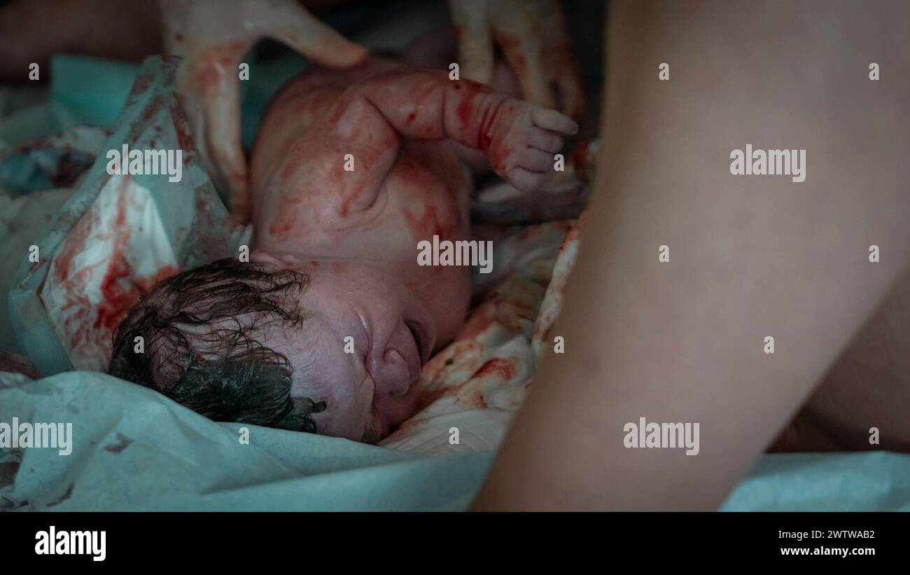 Authentisches Geburtsbild - Ein weinendes neugeborenes Mädchen mit dunklen Haaren, die kurz nach der Geburt mit Blut bedeckt sind. Die Nabelschnur ist noch befestigt. Stockfoto