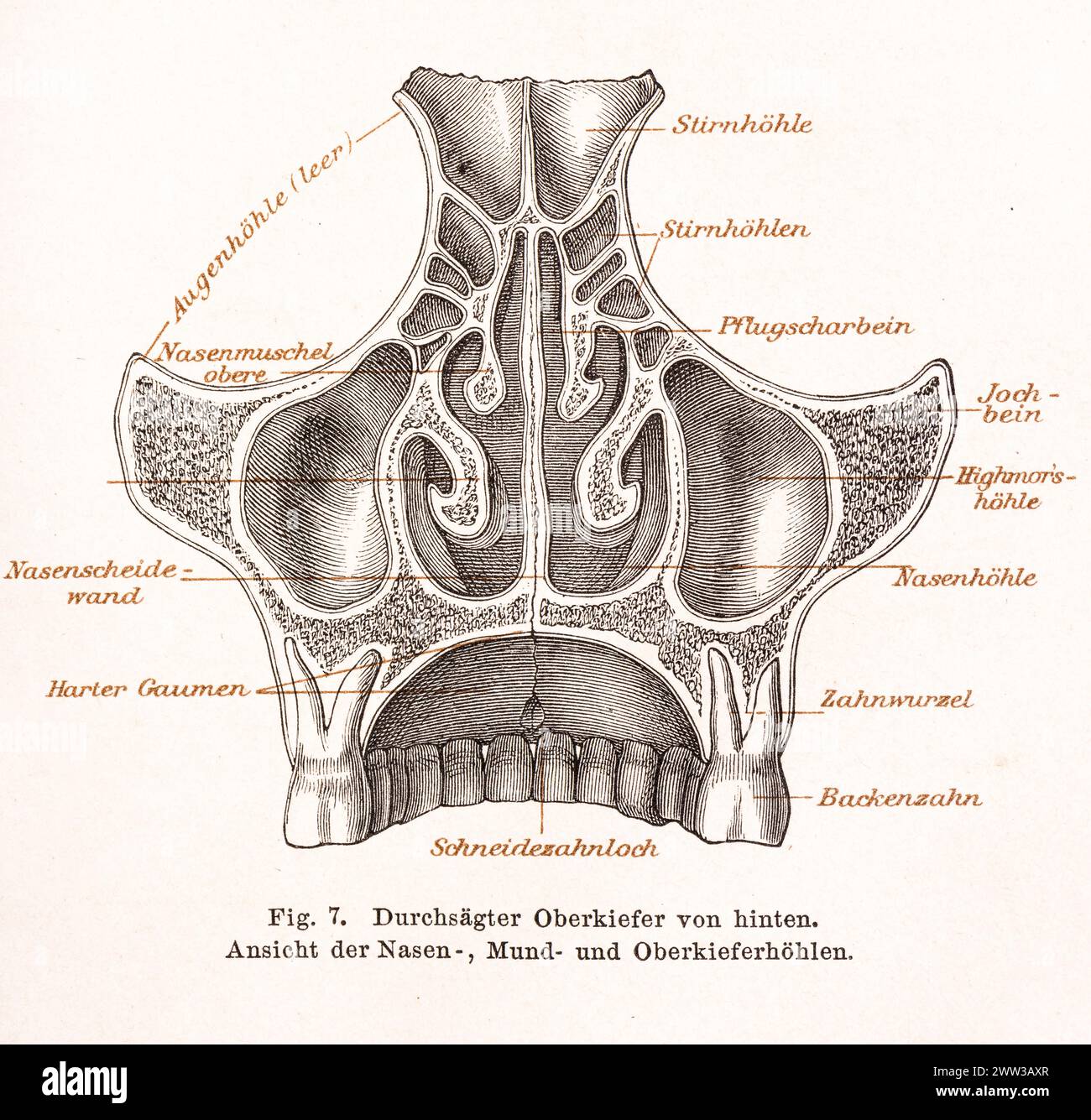 Medizin, Anatomie, Illustration, Zeichnung, detaillierte Darstellung des durchgesägten Oberkiefers und der Nasenhöhlen, Mundhöhle und Oberkiefer Stockfoto