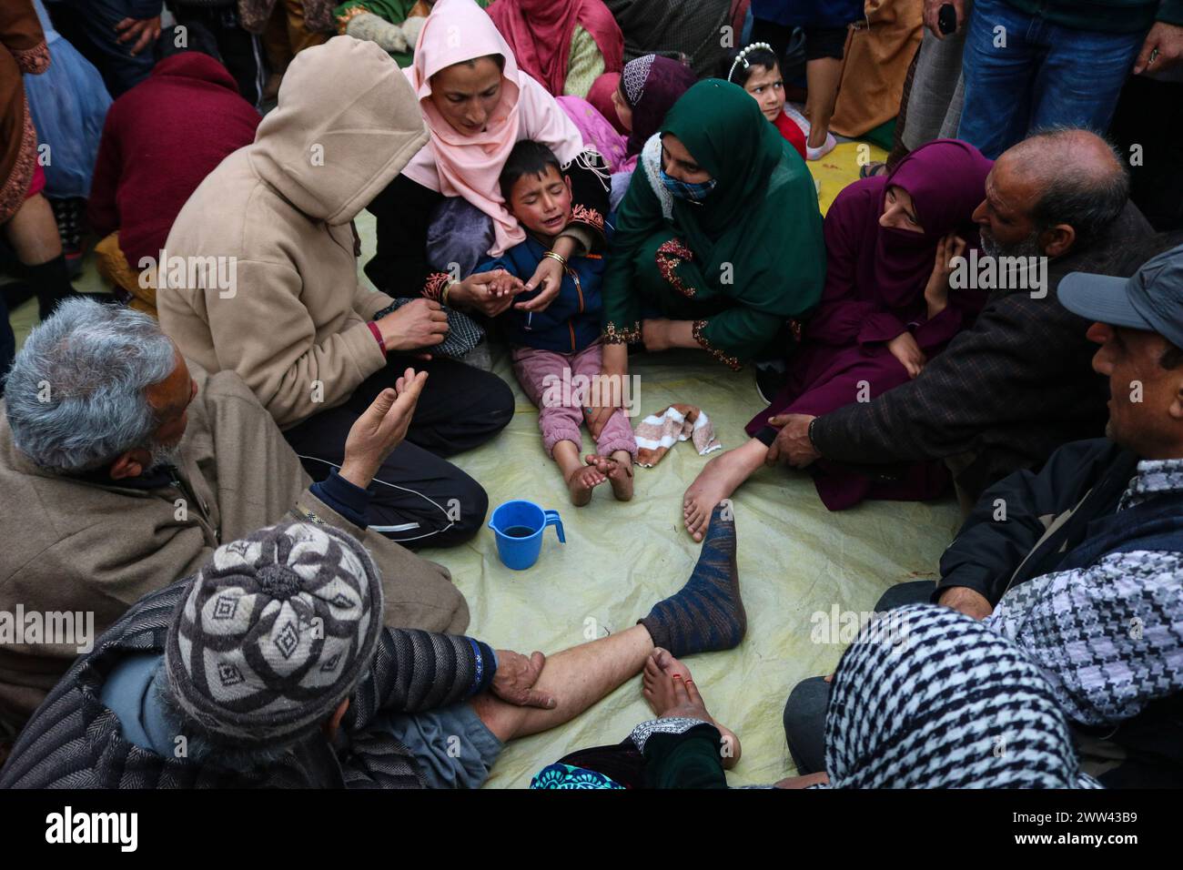 Srinagar, Indien. März 2024. 21. März 2024, Srinagar, Indien: Patienten erhalten Blutegel-Therapie von einem Praktiker, Tausende von Patienten mit verschiedenen Hautkrankheiten treffen sich in Hazratbal, am Stadtrand von Srinagar, um die Blutegel-Behandlung zu erhalten. In dieser Jahrhunderte alten alternativen Behandlung verwenden die Praktizierenden Blutegel, um unreines Blut vom betroffenen Patienten zu saugen. Am 21. März 2024 in Srinagar, Indien. (Foto: Firdous Nazir/ Credit: Eyepix Group/Alamy Live News Stockfoto