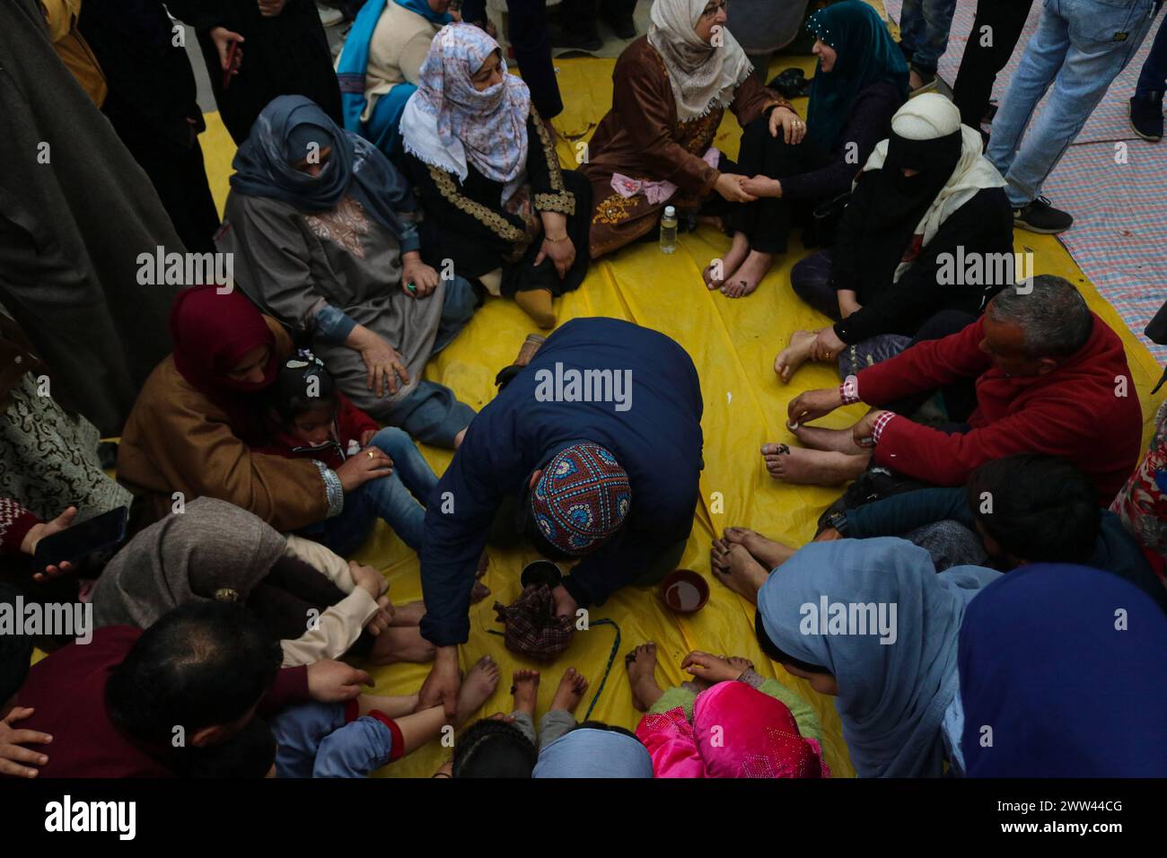 Srinagar, Indien. März 2024. Patienten erhalten Blutegeltherapie von einem Arzt, Tausende von Patienten mit verschiedenen Hautkrankheiten versammeln sich in Hazratbal, am Stadtrand von Srinagar, um die Blutegelbehandlung zu erhalten. In dieser Jahrhunderte alten alternativen Behandlung verwenden die Praktizierenden Blutegel, um unreines Blut vom betroffenen Patienten zu saugen. Am 21. März 2024 in Srinagar, Indien. (Kreditbild: © Firdous Nazir/OKULARIS via ZUMA Press Wire) NUR REDAKTIONELLE VERWENDUNG! Nicht für kommerzielle ZWECKE! Stockfoto