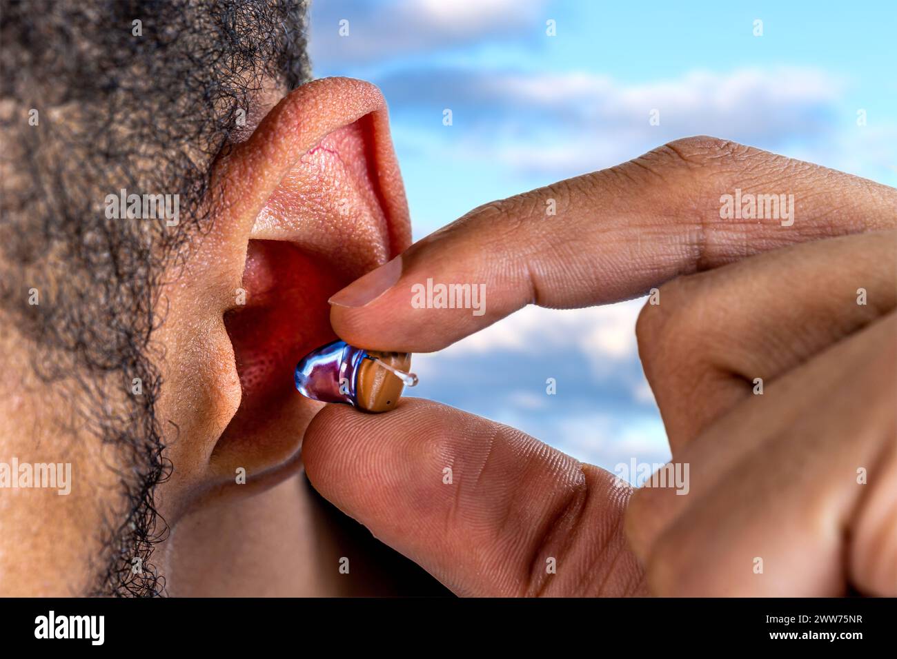 Nahaufnahme zur Positionierung eines digitalen Hörgerätes bei einem jungen Mann. Stockfoto