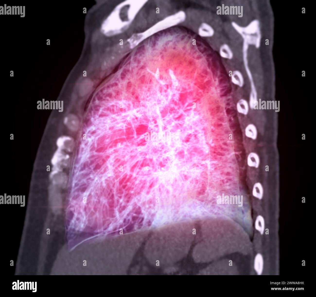 CT-3D-Darstellung von Brust oder Lunge mit Trachea und Lunge im Respirationssystem. Stockfoto