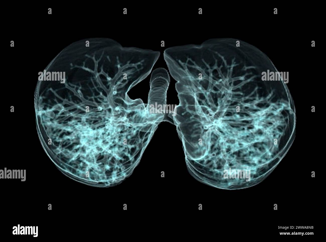 CT-3D-Darstellung von Brust oder Lunge mit Trachea und Lunge im Respirationssystem. Stockfoto