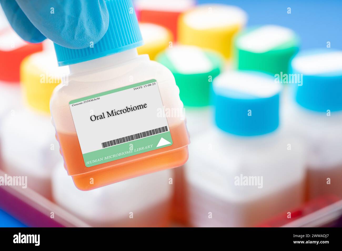 Orales Mikrobiom. Die Umgebung im menschlichen Mund ist für das Wachstum charakteristischer Mikroorganismen geeignet. Stockfoto Orales Mikrobiom. Die Umgebung im menschlichen Mund ist für das Wachstum charakteristischer Mikroorganismen geeignet. Stockfoto