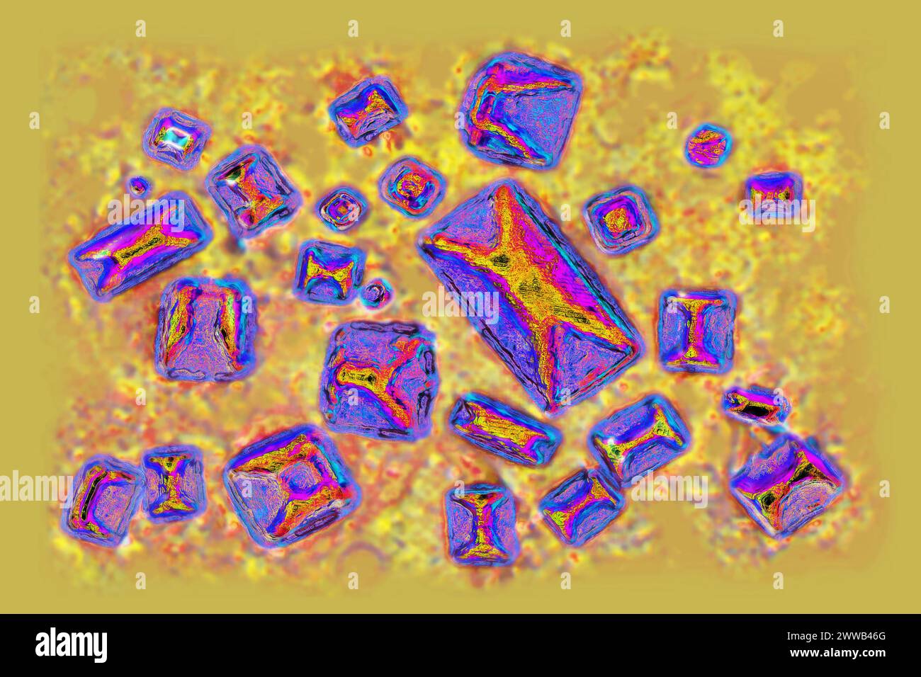 Calciumoxalate (ionischer Kristall, der an fast 80 % der Zusammensetzung von Nierensteinen beteiligt ist). Optische Mikroskopie. Stockfoto