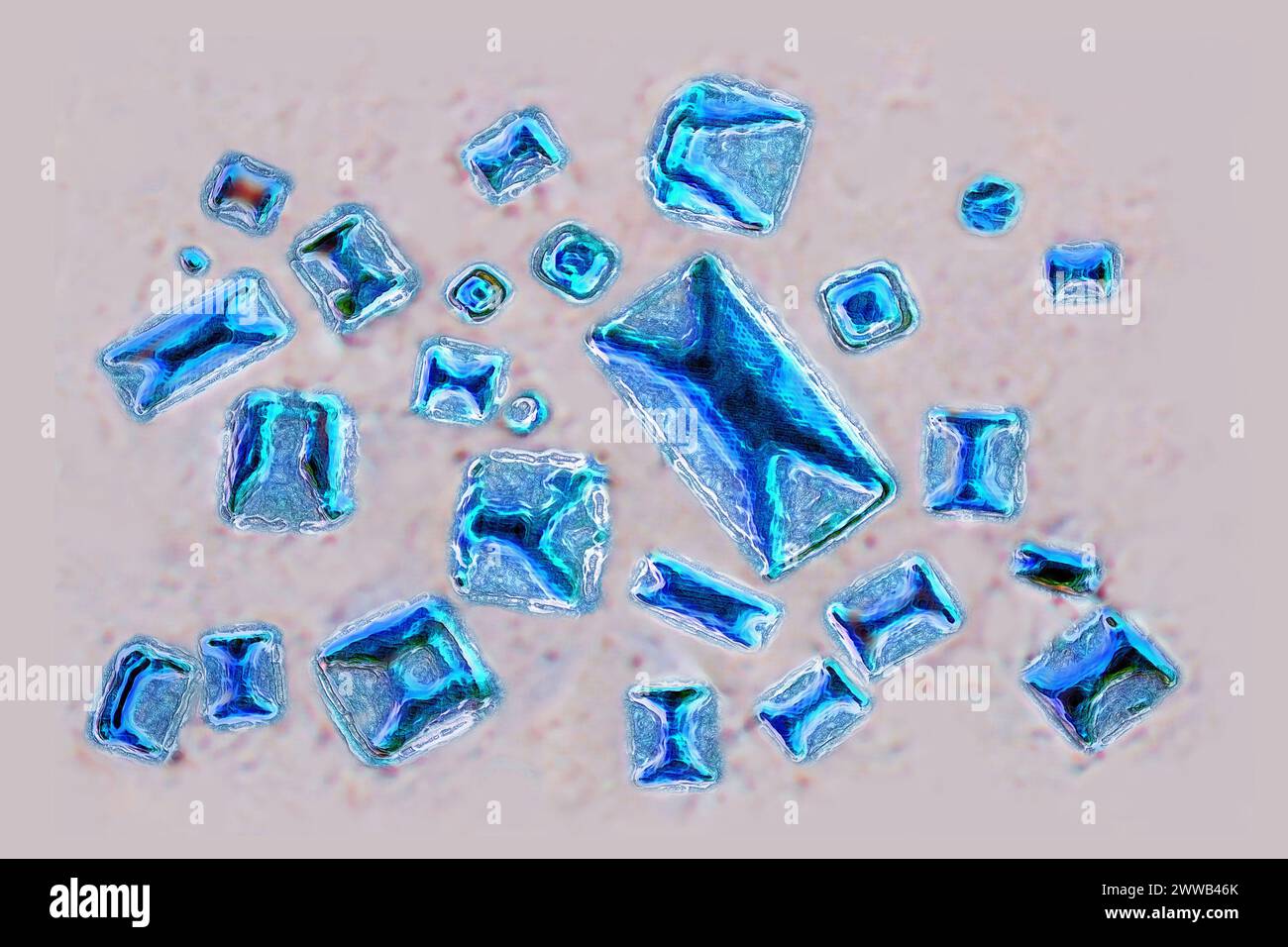 Calciumoxalate (ionischer Kristall, der an fast 80 % der Zusammensetzung von Nierensteinen beteiligt ist). Optische Mikroskopie. Stockfoto