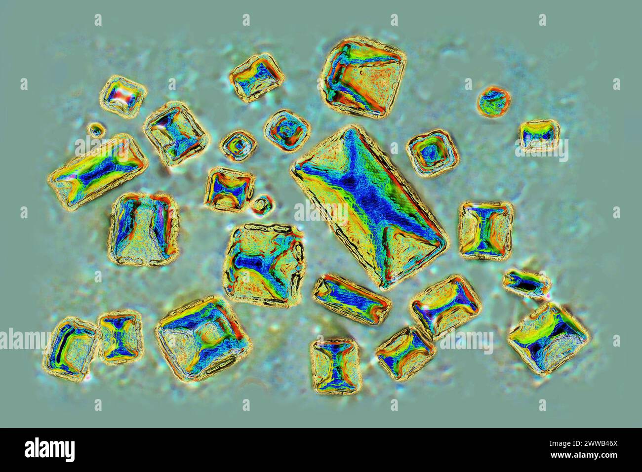 Calciumoxalate (ionischer Kristall, der an fast 80 % der Zusammensetzung von Nierensteinen beteiligt ist). Optische Mikroskopie. Stockfoto