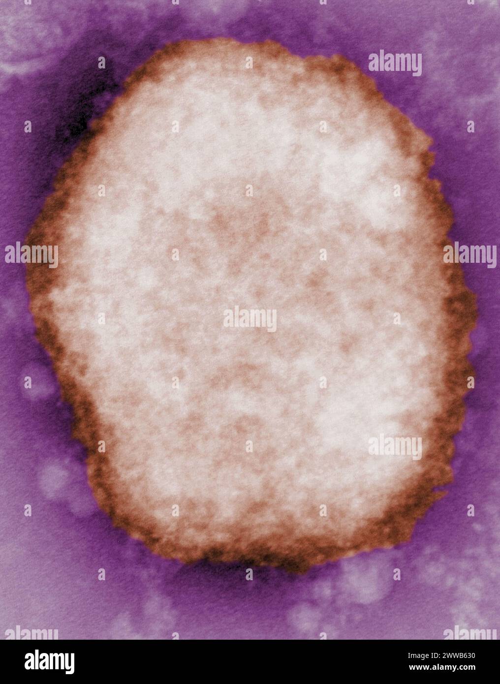 Stark vergrößertes negativ-Fleck-Transmissions-Elektronenmikrogramm (TEM) Bild, das ein Typ M Monkeypox Virus oder Maulbeere enthüllt. Stockfoto