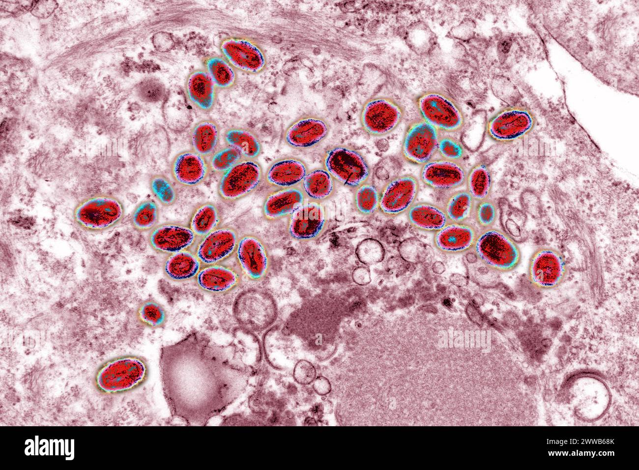Variola-Virus (Poxviren sind große Viren von 300/200/100 nm. Stockfoto