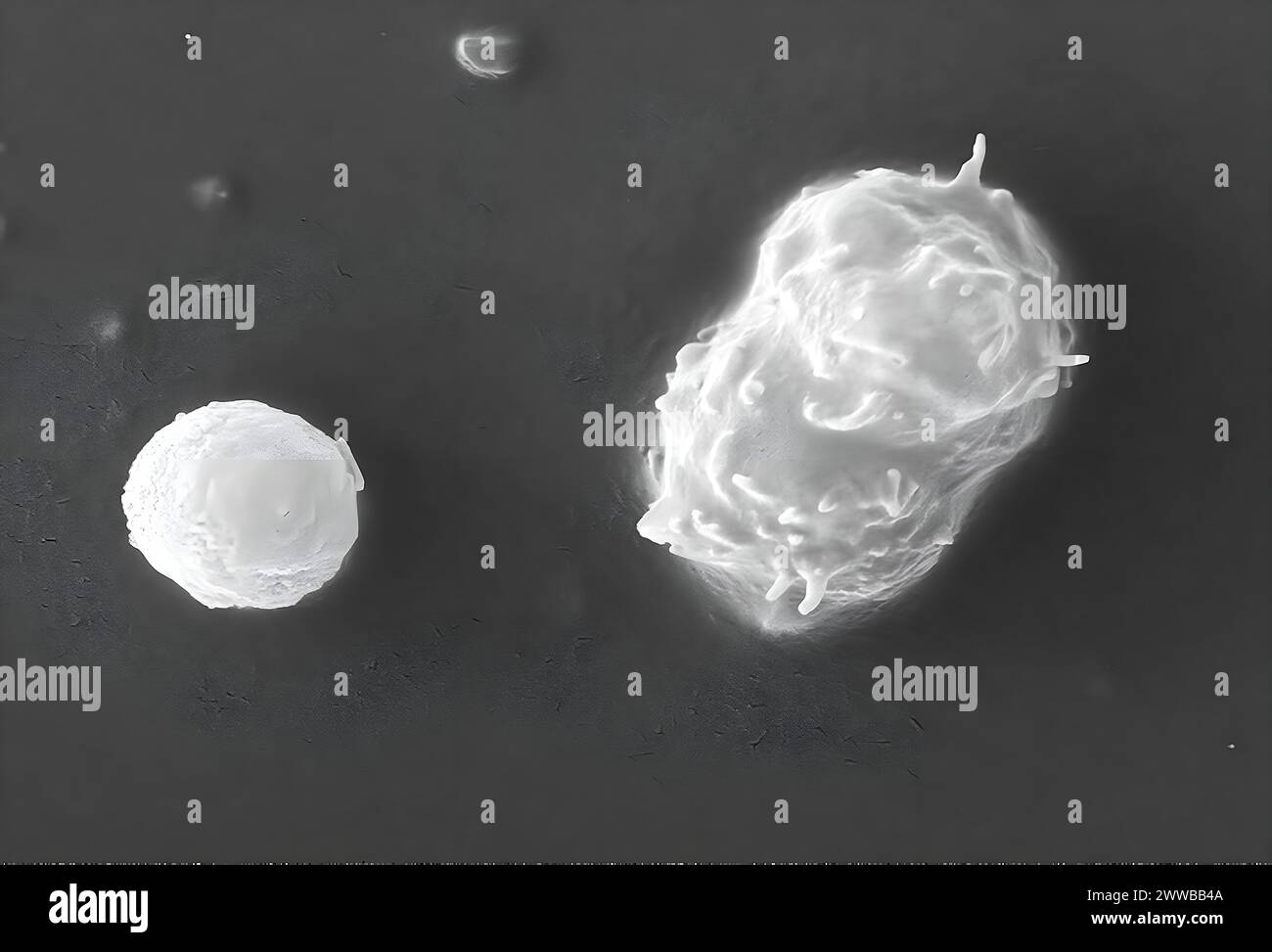 Diese Aufnahme des Rasterelektronenmikroskops (REM) zeigte einige der ultrastrukturellen Merkmale, die auf der Oberfläche zweier Acanthamoeba polyphaga beobachtet wurden. Stockfoto