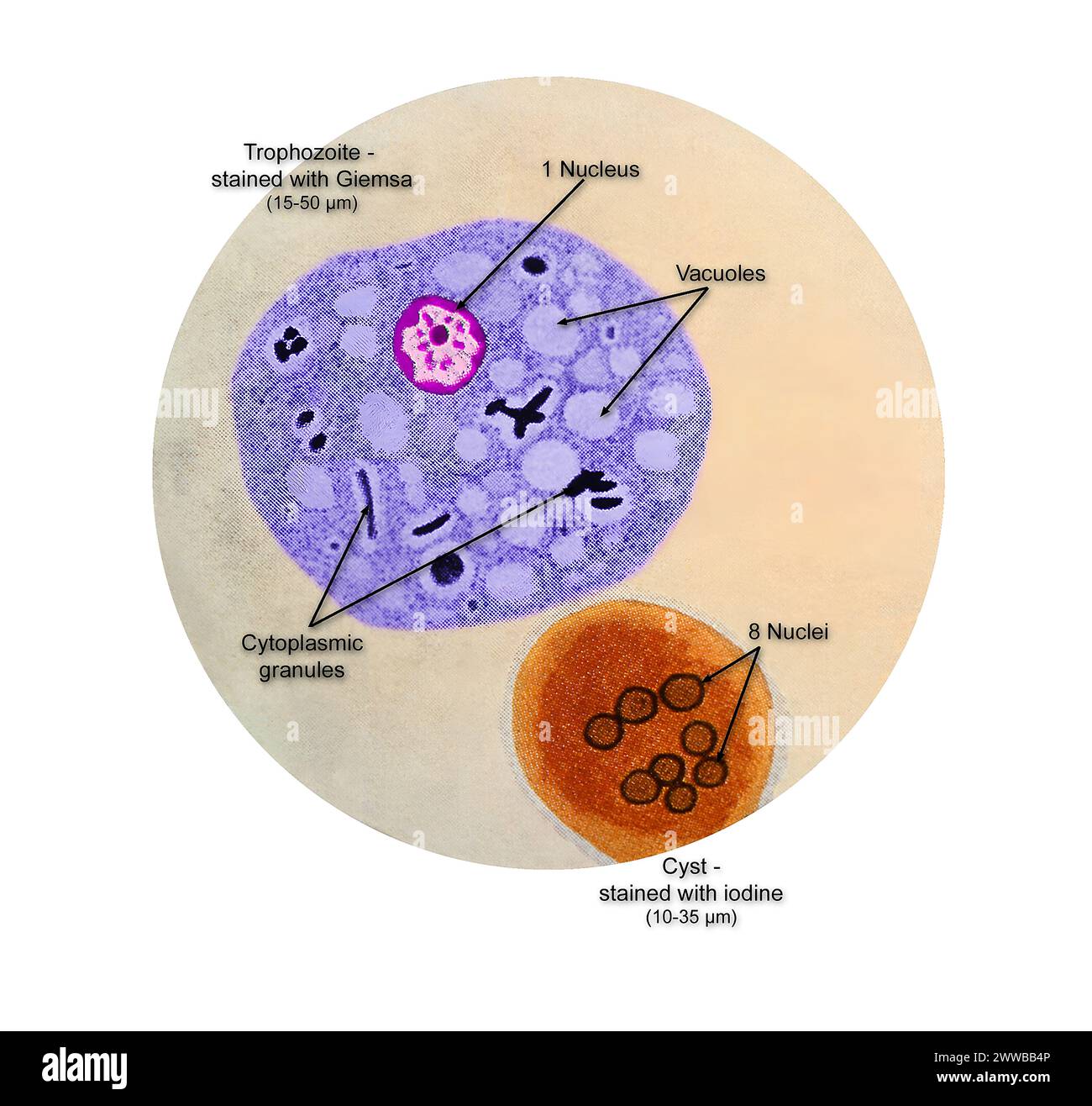 Diese Abbildung eines Komposit-Photomikrographen zeigt die ultrastrukturellen Details, die in zwei Phasen des Lebenszyklus des Parasiten beobachtet werden. Stockfoto