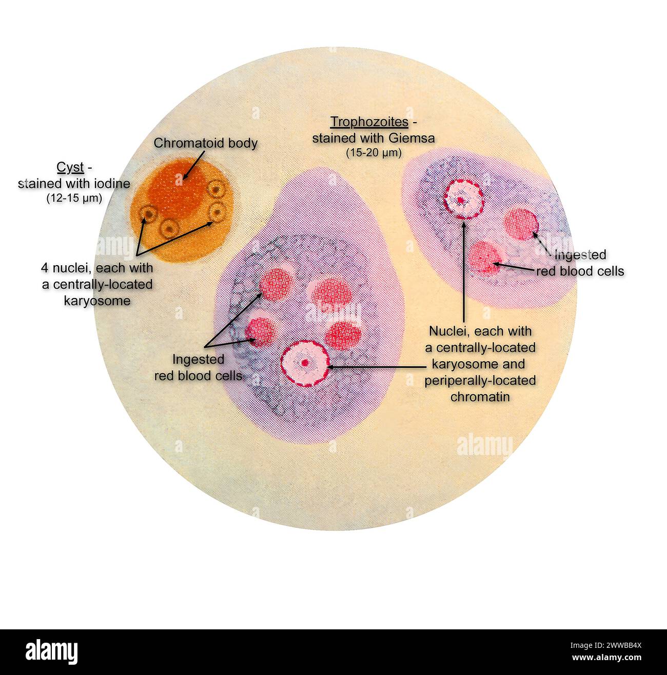 Diese Abbildung eines Komposit-Photomikrographen zeigt die ultrastrukturellen Details, die in zwei Phasen des Lebenszyklus des Parasiten beobachtet wurden. Stockfoto