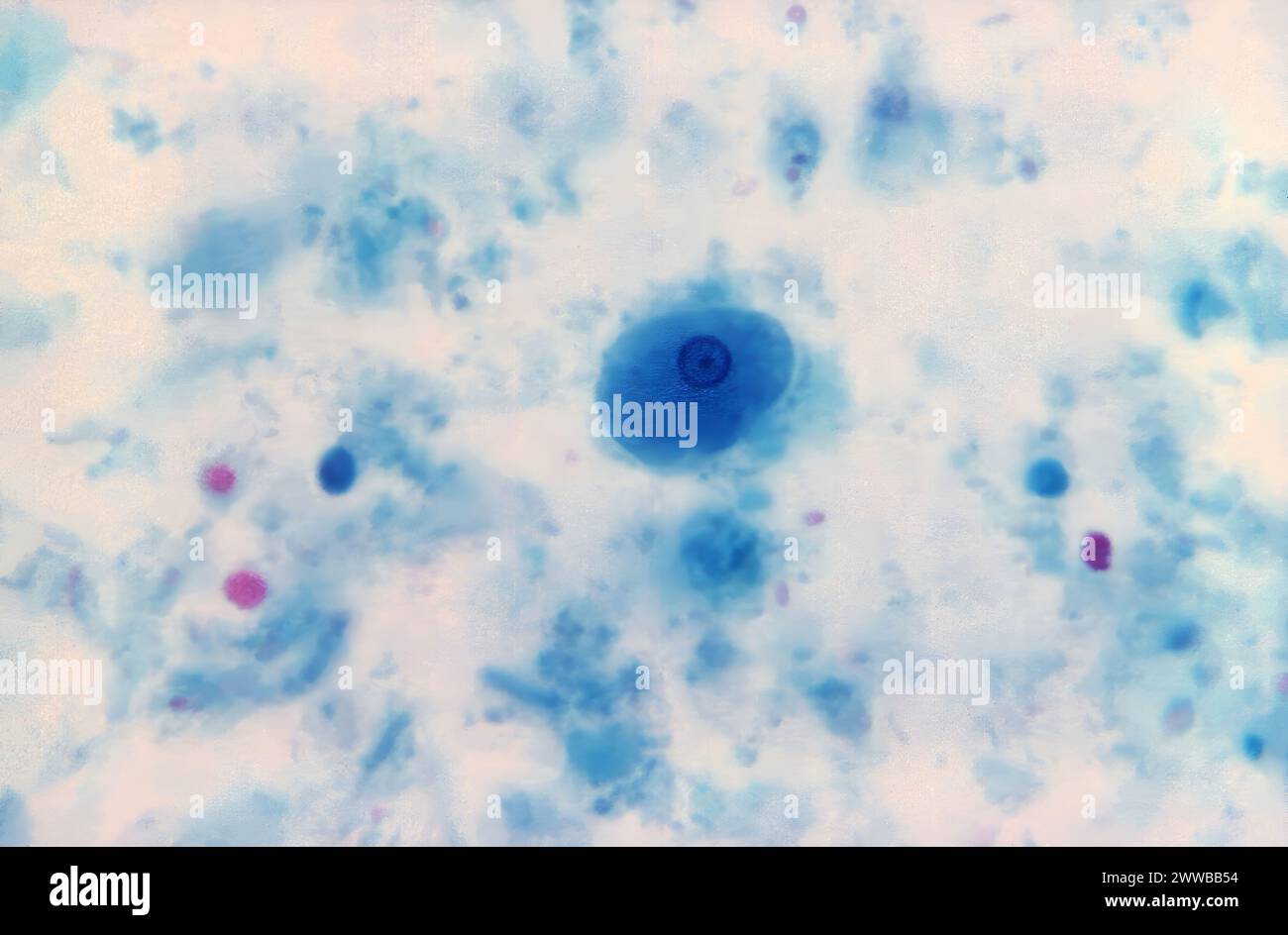 Dieser trichromgefärbte Photomikrograph zeigte das Vorhandensein eines Entamoeba hartmanni-Trophozoiten, der seinen charakteristischen Einzelkern zeigte. Stockfoto