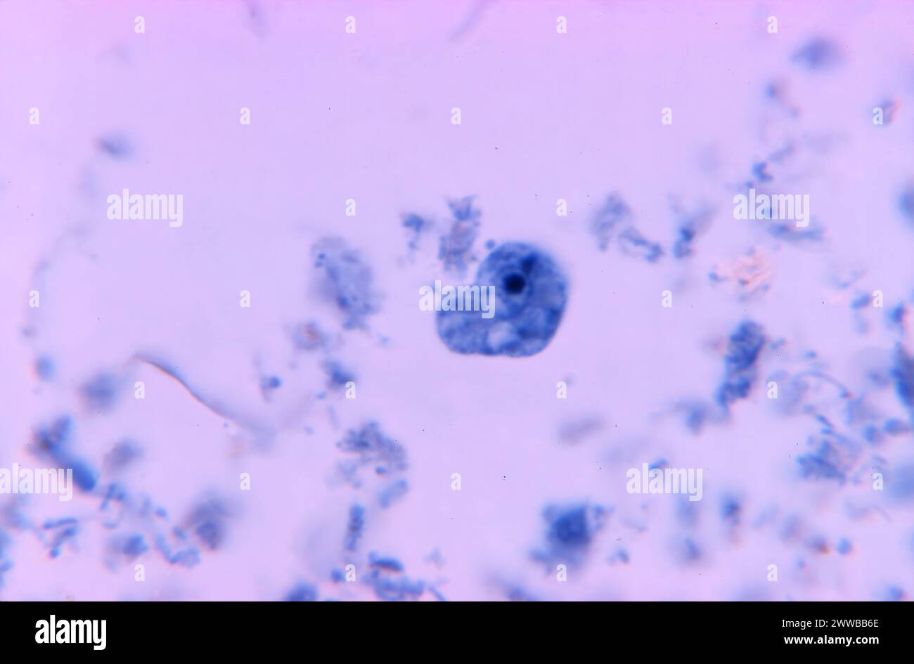 Diese Photomikrographie zeigt eine einzelne Iodamoeba butschlii (buetschlii) parasitische Zyste, in der der Kern eine einzige große zu enthalten scheint. Stockfoto