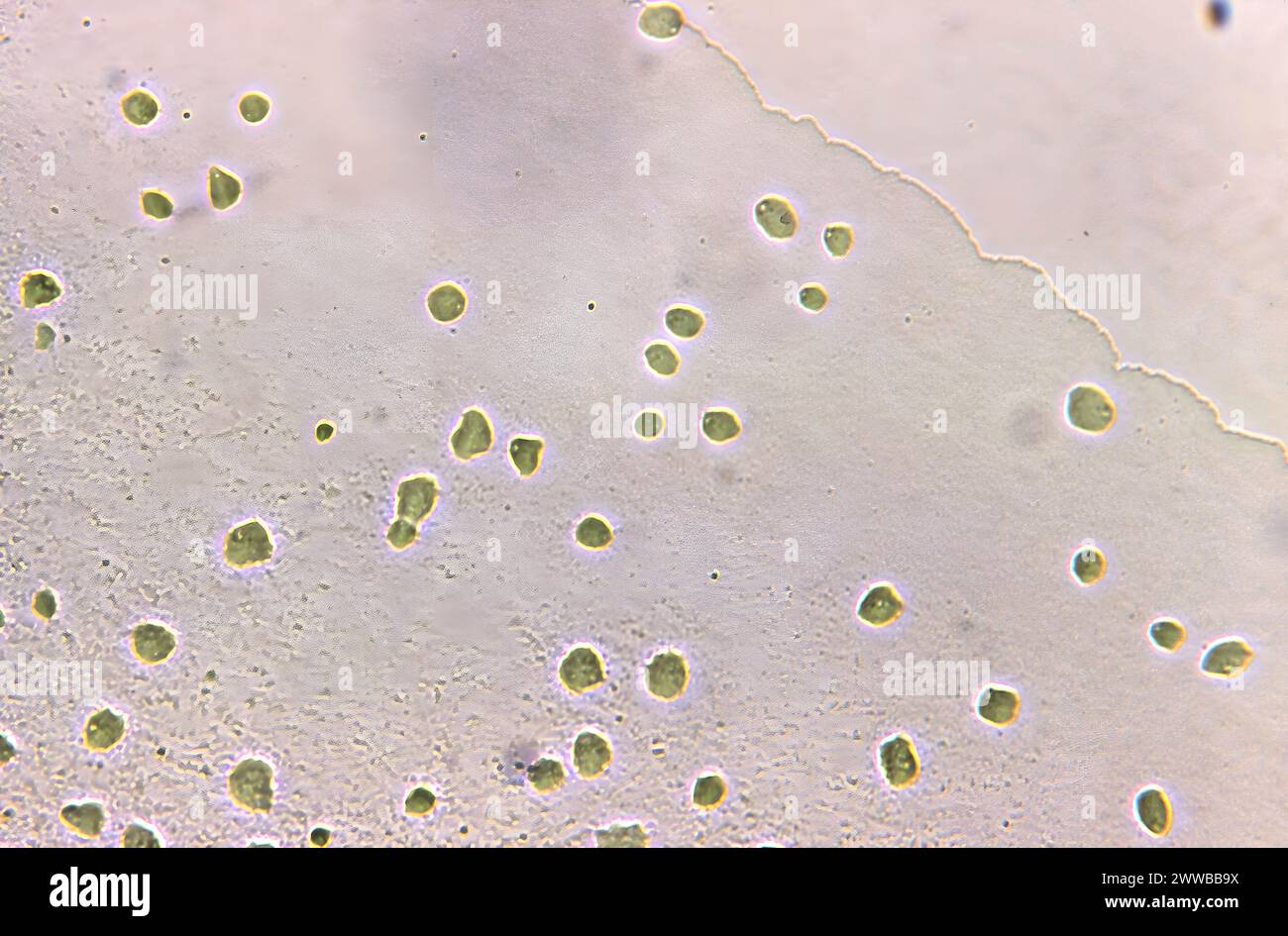 Unter 125-facher Vergrößerung zeigte dieser Photomikrograph eines Agar-Mediums das Vorhandensein zahlreicher nicht pathogener Naegleria gruberi Amöben. CDC 1971. Stockfoto