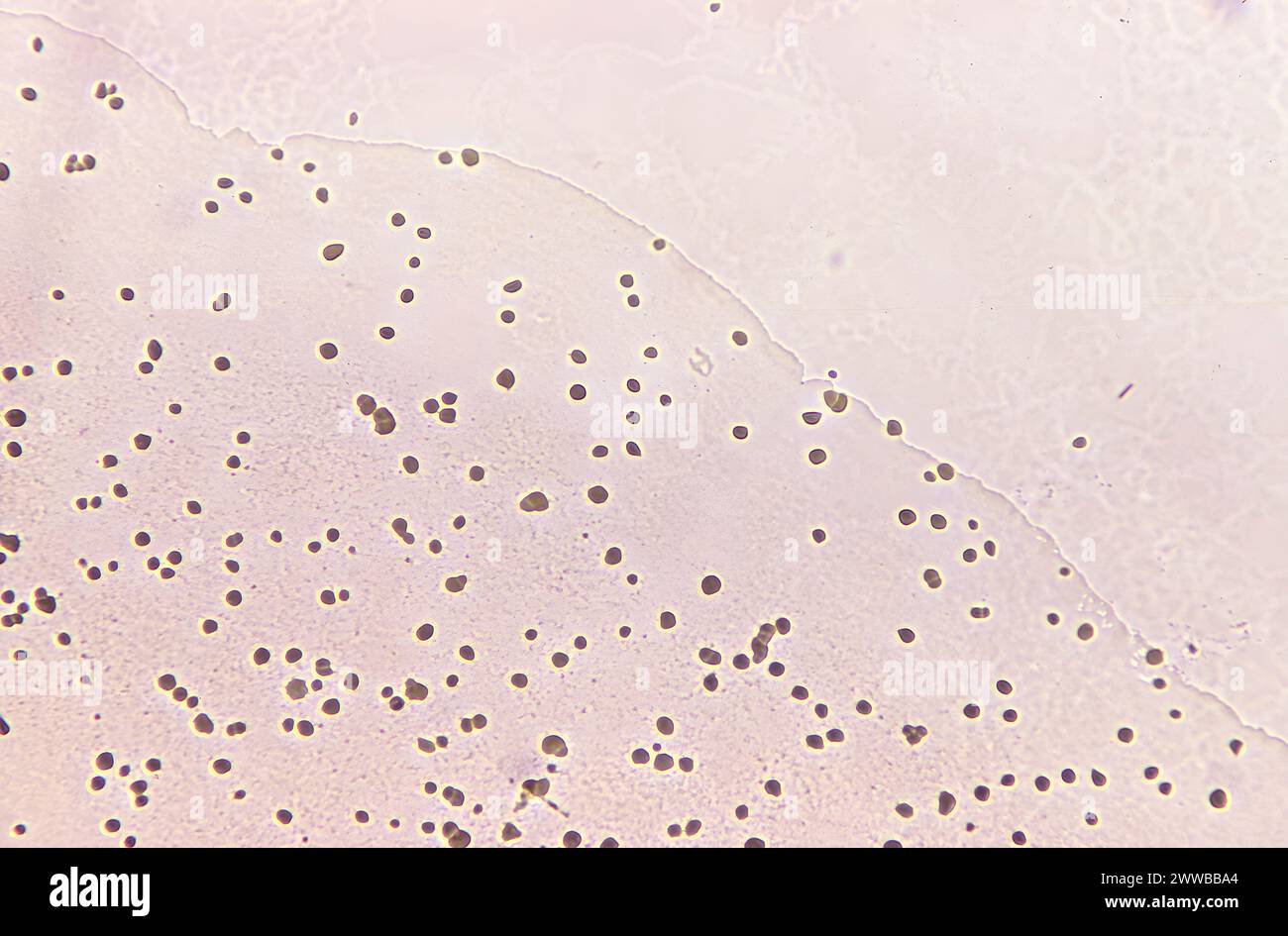 Unter 50-facher Vergrößerung zeigte dieser Photomikrograph eines Agar-Mediums das Vorhandensein zahlreicher nicht pathogener Naegleria gruberi Amöben. CDC 1971. Stockfoto