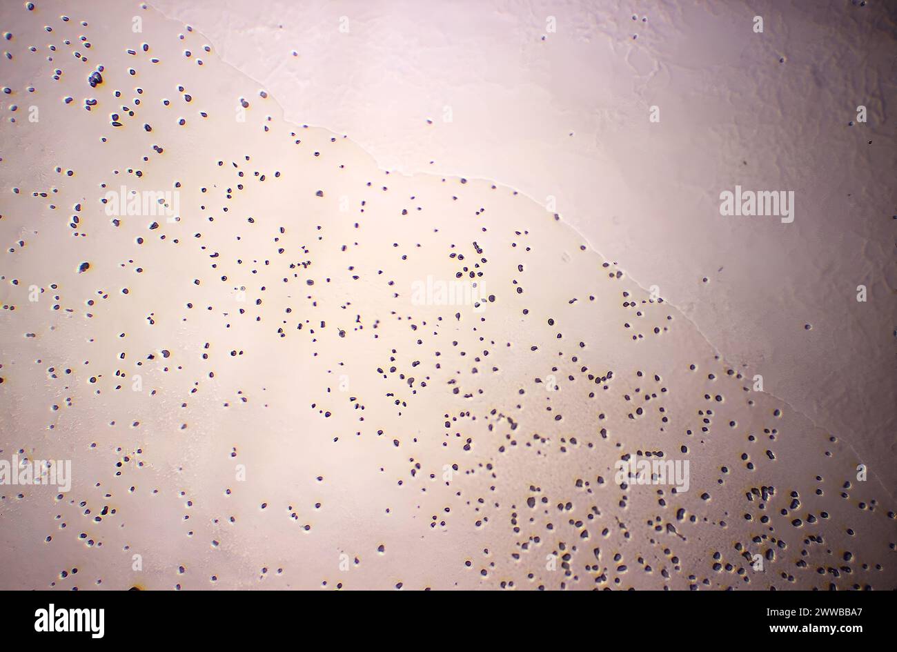 Unter 31-facher Vergrößerung zeigte dieser Photomikrograph eines Agar-Mediums das Vorhandensein zahlreicher nicht pathogener Naegleria gruberi Amöben. CDC 1971. Stockfoto