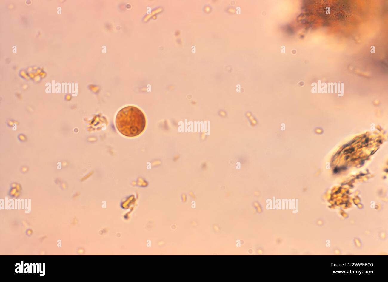 Diese Photomikrographie eines jodgefärbten Exemplars zeigte eine Entamoeba hartmanni-Zyste, die einen einzelnen Kern enthielt. Stockfoto