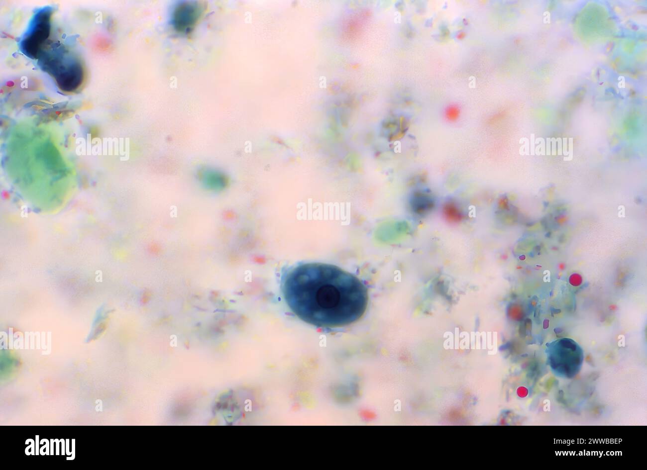 Dieser trichromgefärbte Photomikrograph zeigte einen parasitären Entamoeba histolytica trophozoit, der einen einzigen runden Kern enthielt. Stockfoto