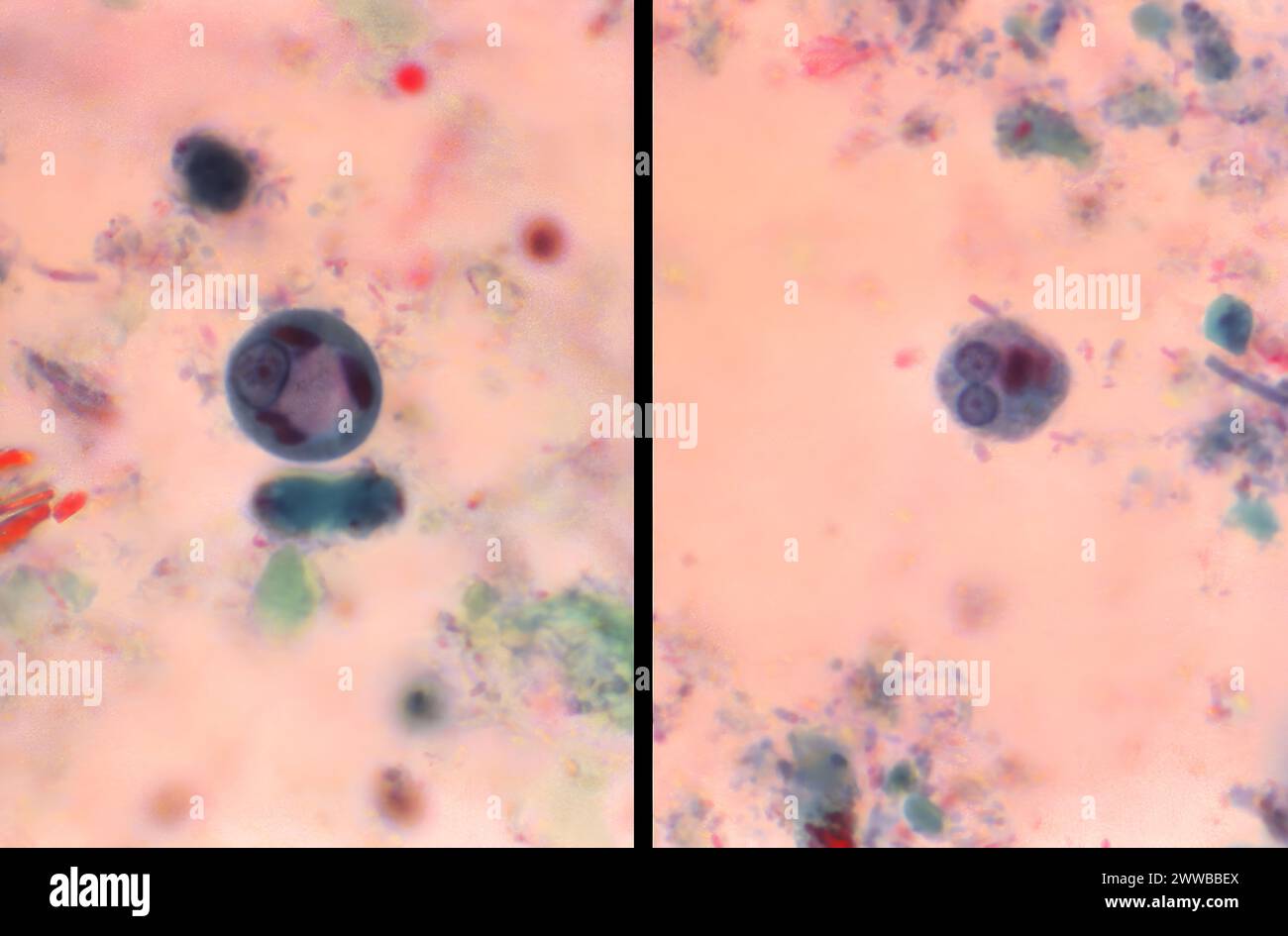 Dieser Photomikrograph zeigt zwei Entamoeba histolytica-Zysten. Stockfoto