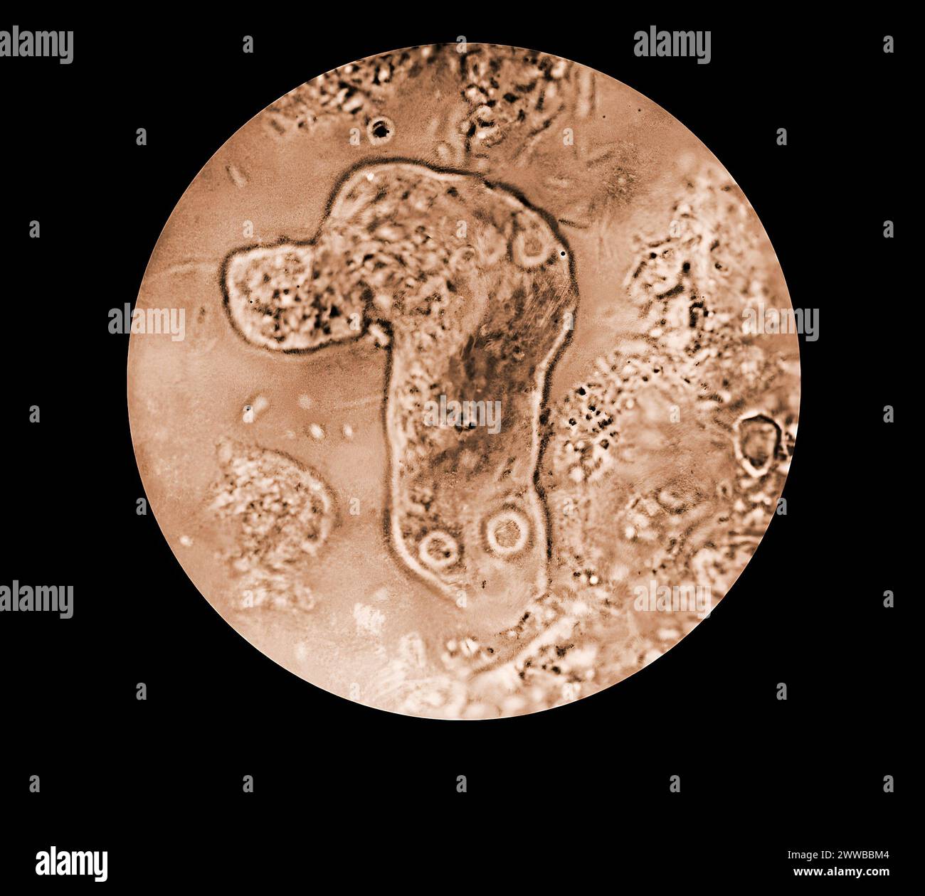 Dieser Photomikrograph zeigte das Vorhandensein eines Entamoeba histolytica trophozoiten, der hier während seines Lebens fotografiert wurde. Stockfoto
