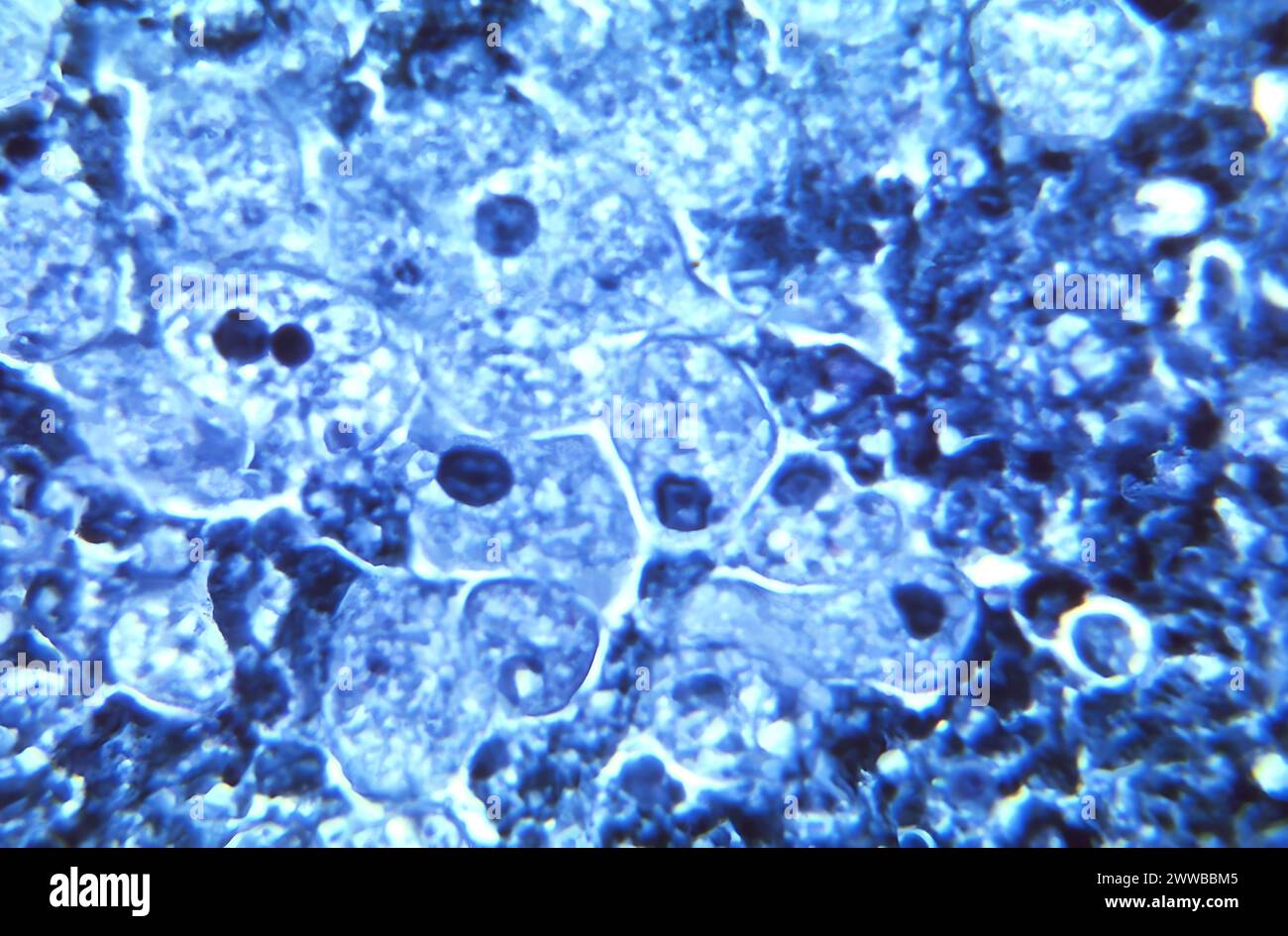 Unter 900-facher Vergrößerung zeigte dieser Photomikrograph das Vorhandensein einer Reihe von Trophozoiten des parasitären Organismus Entamoeba histolytica. Stockfoto